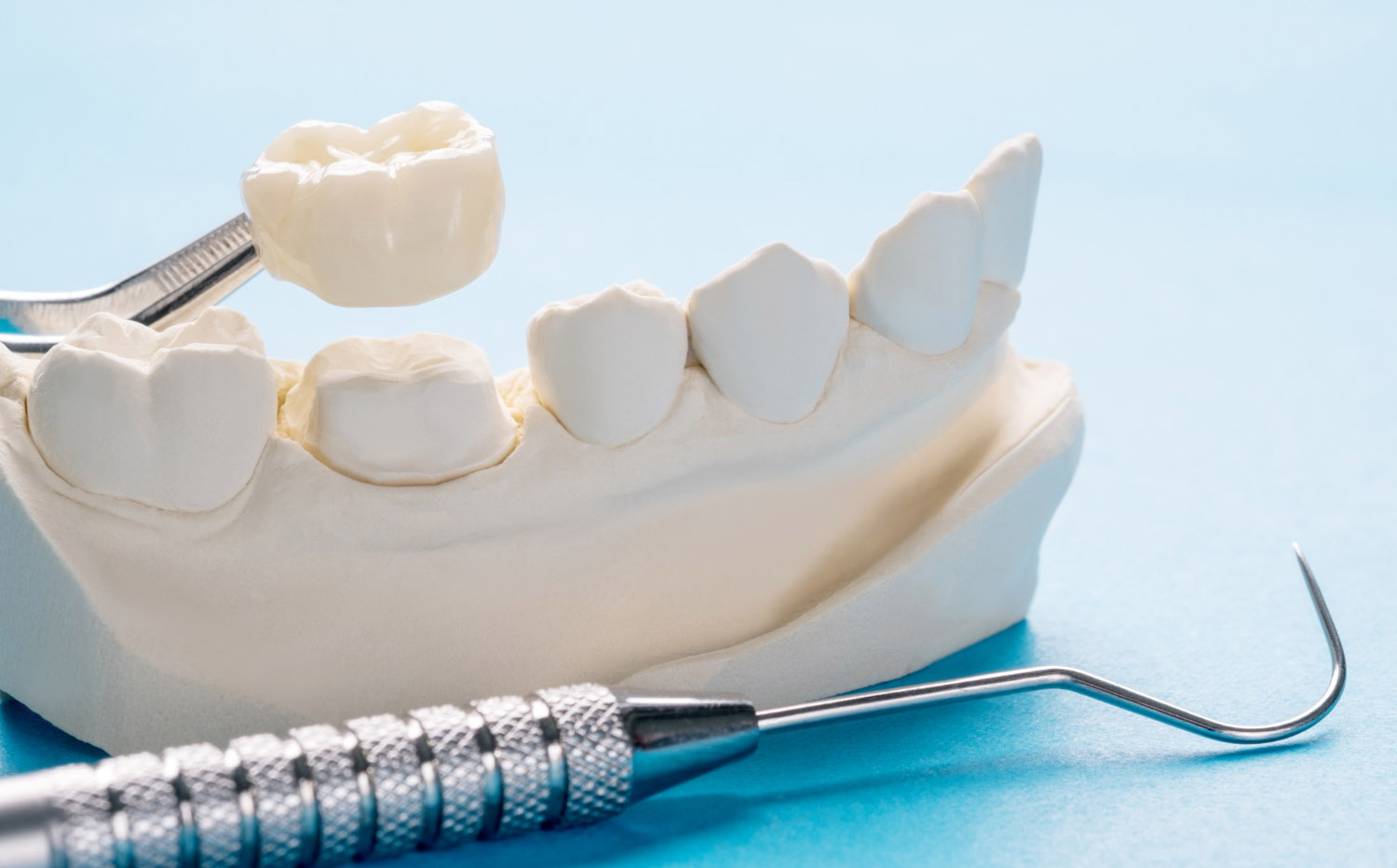 Dental Crowns Treatment
